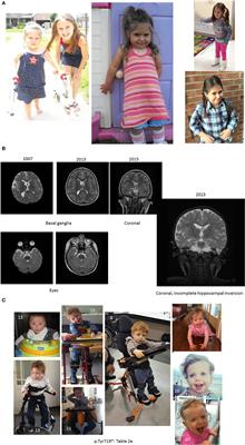 The Eight and a Half Year Journey of Undiagnosed AD: Gene Sequencing and Funding of Advanced Genetic Testing Has Led to Hope and New Beginnings